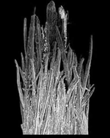 Microscope image of a damaged hair strand with split ends